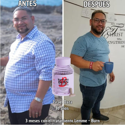 🔥 Lemme Burn® – 60 Cápsulas | Activa tu metabolismo desde adentro con Lemme Burn (PRODUCTO ORIGINAL)