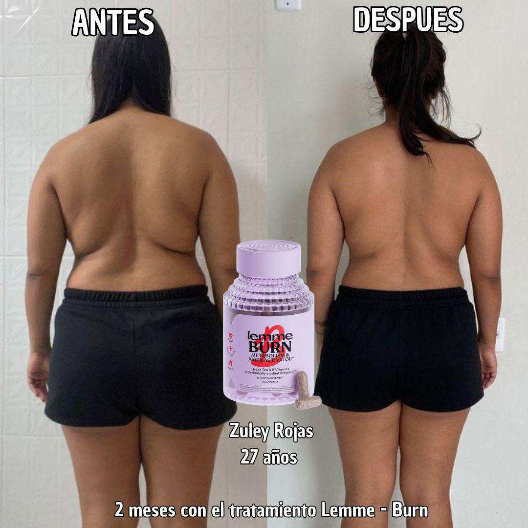🔥 Lemme Burn® – 60 Cápsulas | Activa tu metabolismo desde adentro con Lemme Burn (PRODUCTO ORIGINAL)